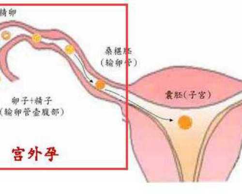 北京做输卵管疏通的平均价格,北京协和医院生殖中心供卵试管技术怎么样？