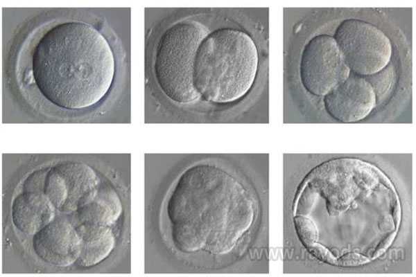 兰州世纪助孕生殖中心靠谱吗_试管婴儿胚胎养囊胚要求有哪些？