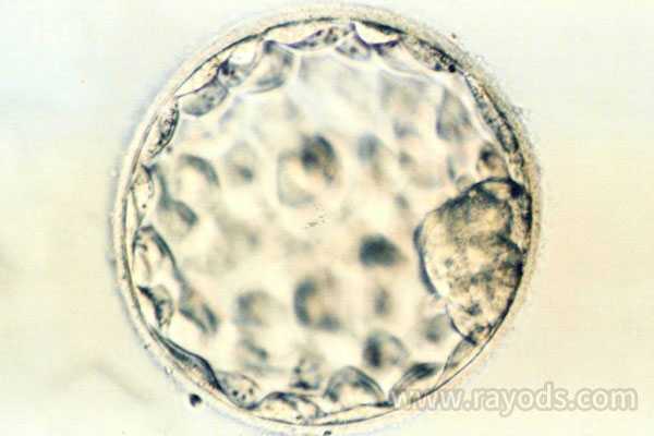 兰州世纪助孕生殖中心靠谱吗_试管婴儿胚胎养囊胚要求有哪些？